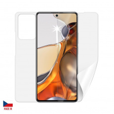 Screenshield fólie na celé tělo pro XIAOMI 11T Pro Screenshield fólie na celé tělo pro XIAOMI 11T Pro