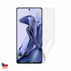 Screenshield fólie na displej pro XIAOMI 11T Screenshield fólie na displej pro XIAOMI 11T